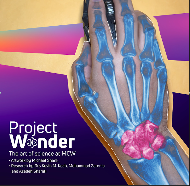 Thumbnail Wrist imaging - Project Wonder